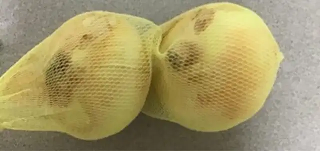 Cebollas